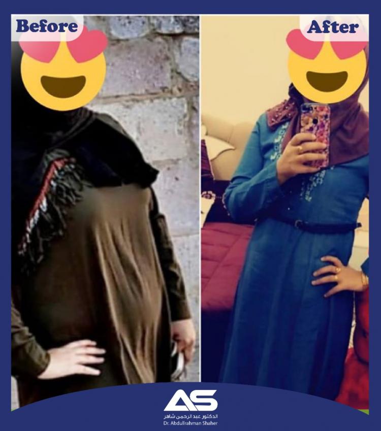 قبل وبعد