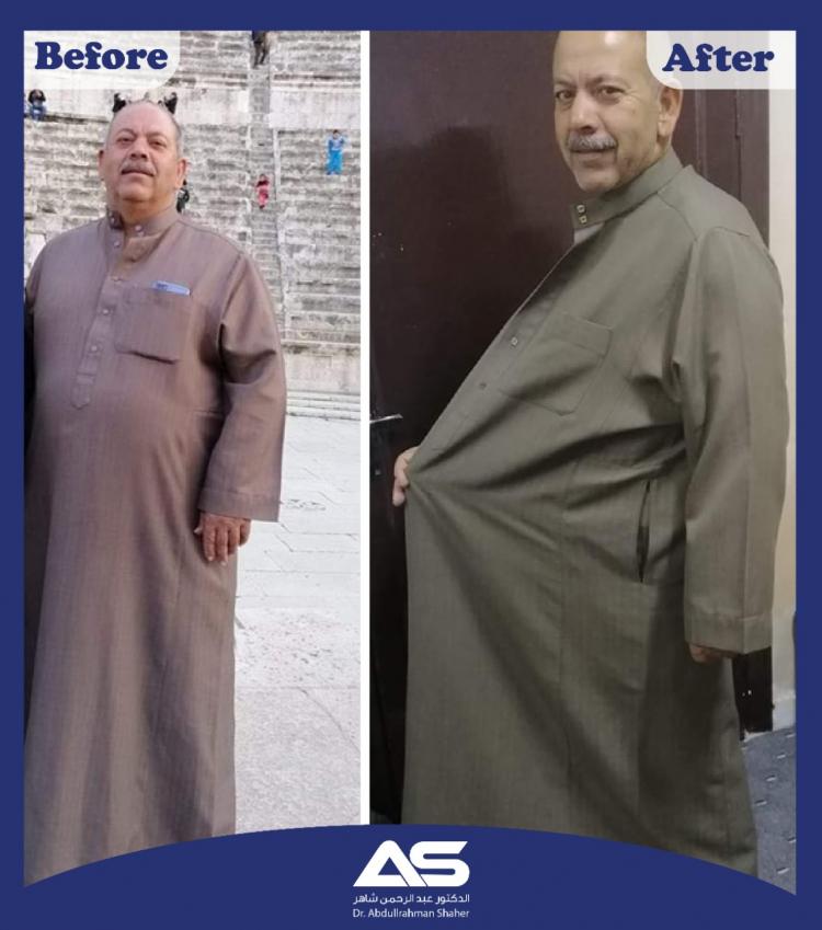 قبل وبعد